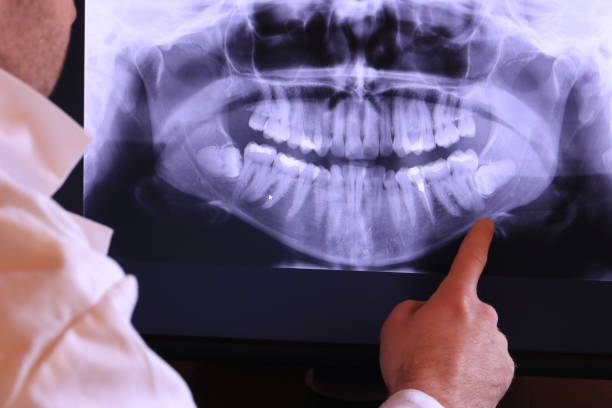 Best Holiday Emergency Dentist in Hornsby Bend, TX