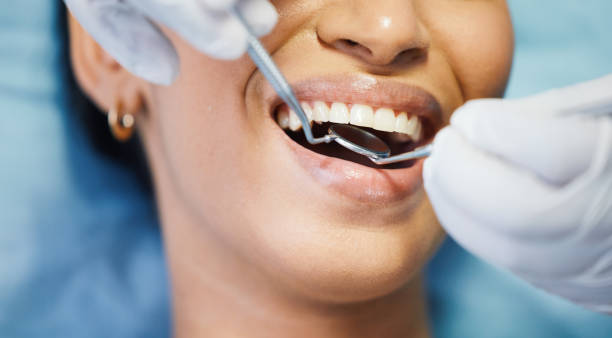 Best Emergency Dentist for Lost Fillings or Crowns in Hornsby Bend, TX