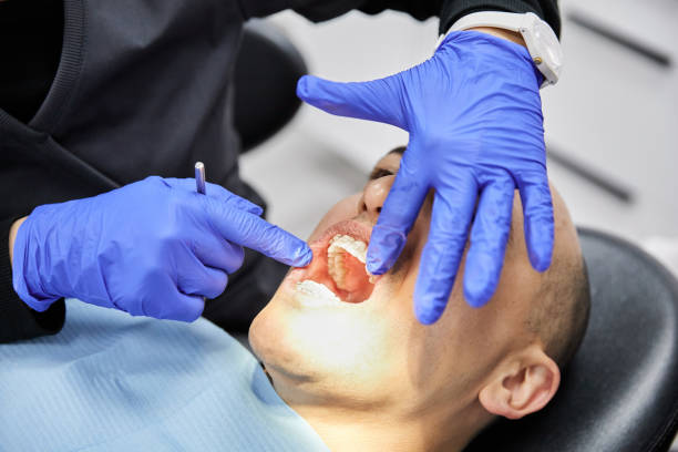 Best Emergency Dentist for Lost Fillings or Crowns in Hornsby Bend, TX