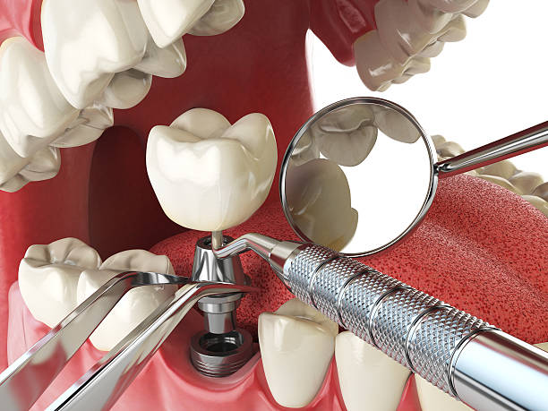 Best Broken or Cracked Tooth Emergency Dentist in Hornsby Bend, TX